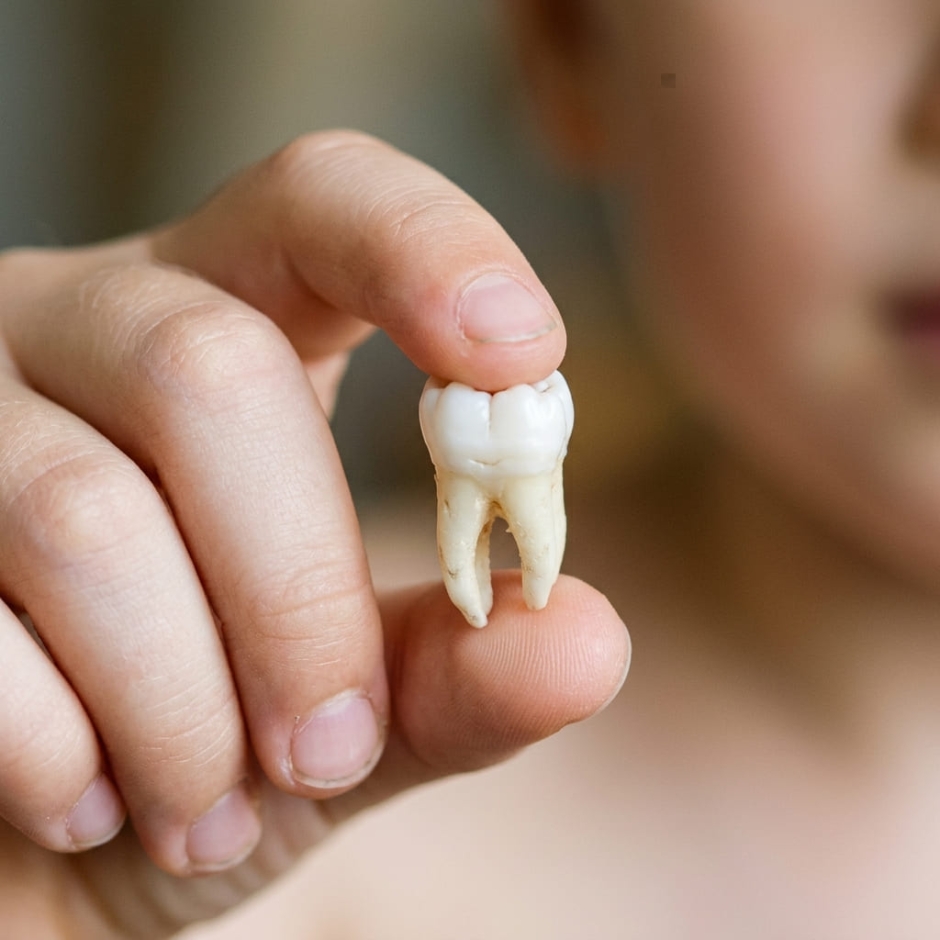 Copilul a scos un dinte permanent: ce trebuie făcut în primele 30 de minute