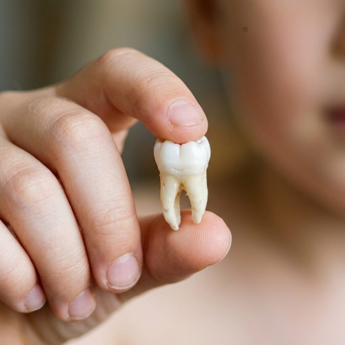 Copilul a scos un dinte permanent: ce trebuie făcut în primele 30 de minute